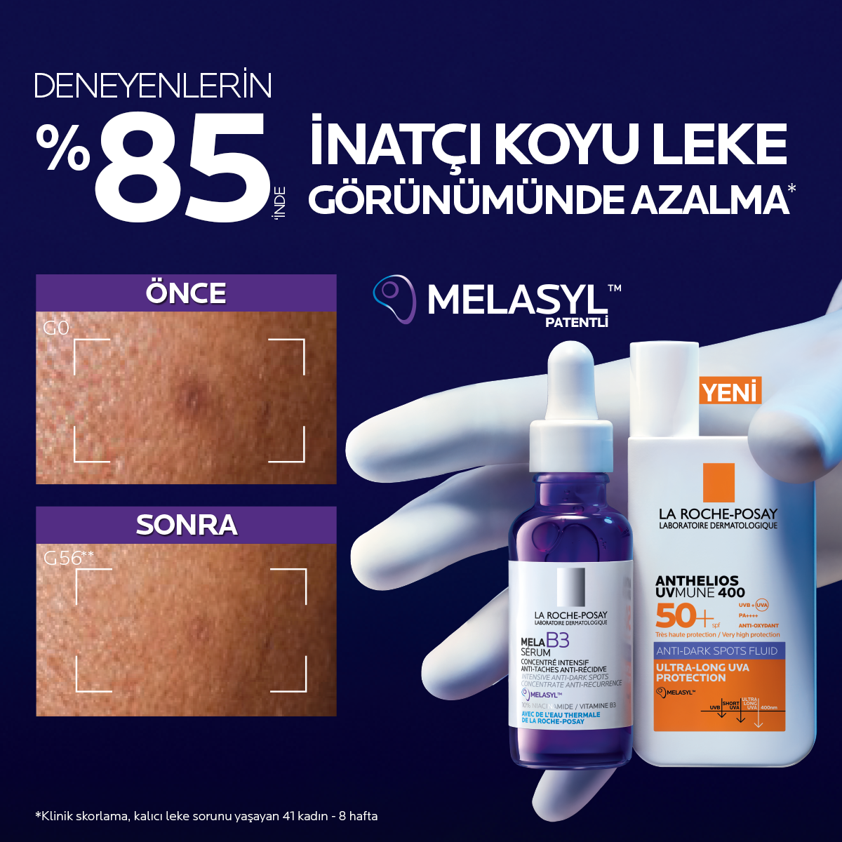 la-roche-posay-anthelios-anti-taches