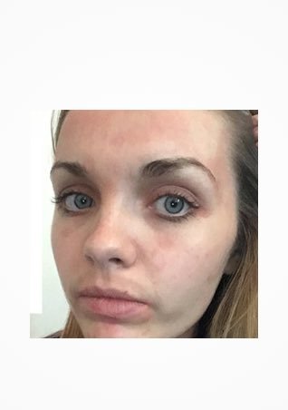 https://www.laroche-posay.com.tr/-/media/project/loreal/brand-sites/lrp/emea/tr/simple-page/landing-page/brand-campaign/instagram_5.jpg