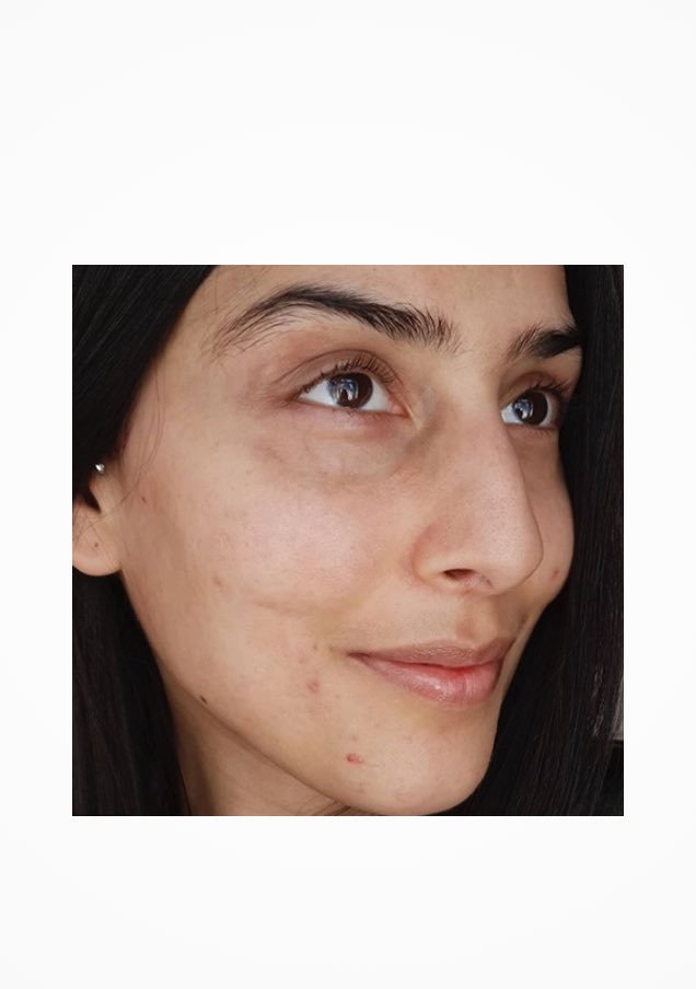 /-/media/project/loreal/brand-sites/lrp/emea/tr/simple-page/landing-page/brand-campaign/instagram_6.jpg?sc_lang=tr-tr
